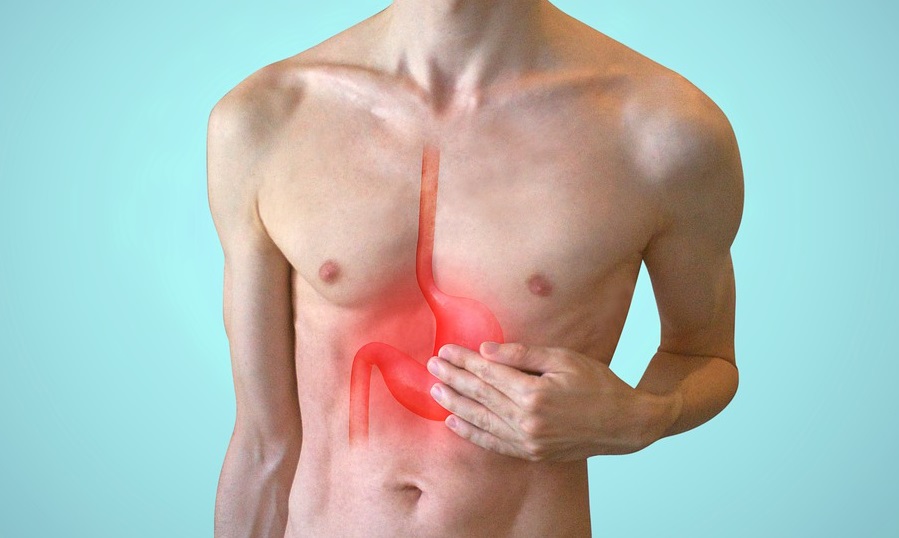 علاج ارتجاع المريء وضيق التنفس